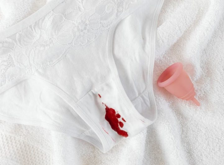 A menstrual cup alongside stained underwear on a clean towel, symbolizing menstrual health.